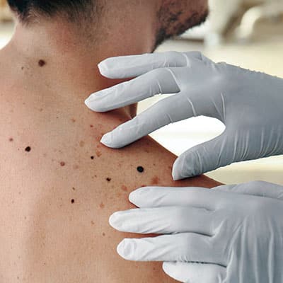 Leia mais sobre o artigo Sua pele não tira férias