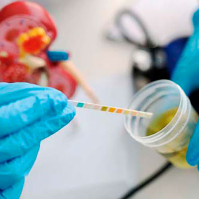 Leia mais sobre o artigo Infecção urinária: como lidar?
