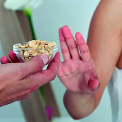 Leia mais sobre o artigo Seu filho tem alergia alimentar?
