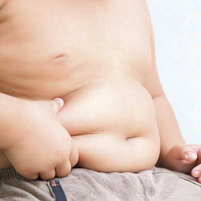 Leia mais sobre o artigo Obesidade infantil: como lidar?